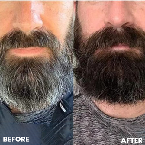 Anti-Grey Hair Prime Serum for Head & Beard | 100% Organic & Effective