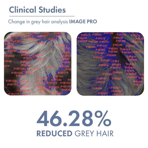 Anti-Grey Hair Prime Serum for Head & Beard | 100% Organic & Effective